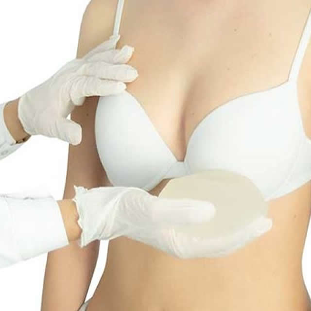 AUMENTO MAMARIO EN GUAYAQUIL