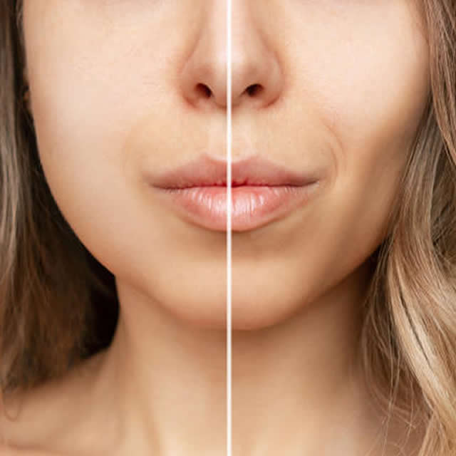 BICHECTOMIA EN GUAYAQUIL